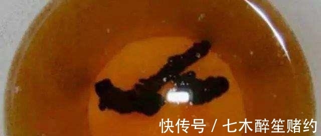 检查|广东一名1岁宝宝喝母乳变成哑巴,医生检查原因,宝妈瘫软在地