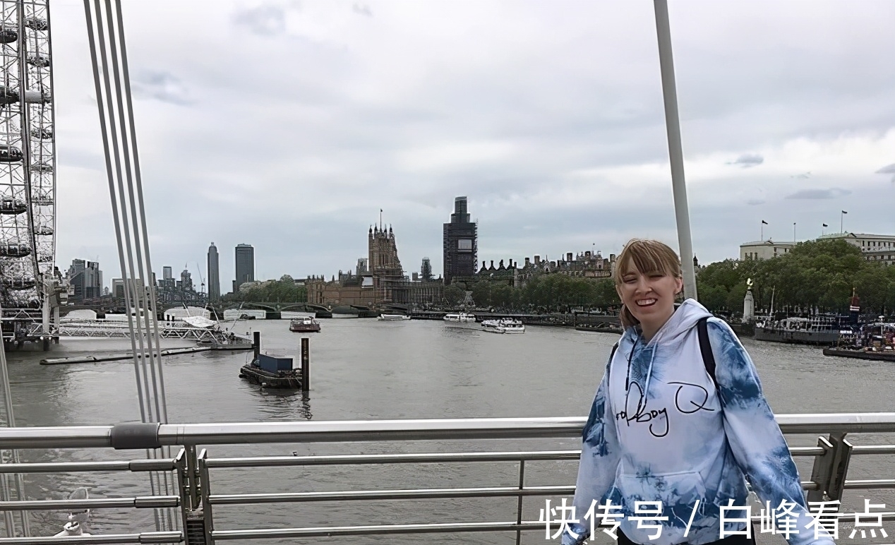 小姑娘|对水过敏的女孩,洗一次澡都可能要她的命,出汗流泪都痛苦