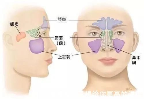 乳头状瘤|鼻窦肿瘤反复发作,影像导航系统手术解难题