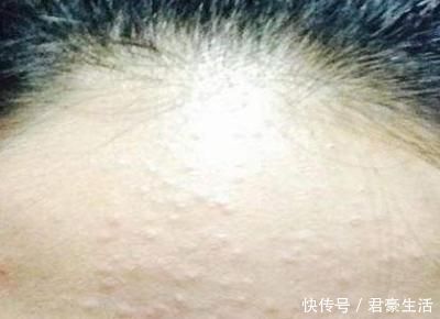 肝脏健康|肝脏健康状态,照照镜子就知道,若1点常出现,别再不当回事!