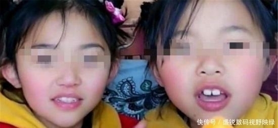 自信心|双胞胎姐妹3岁走失,30年后重逢差距很大,网友看上去像母女