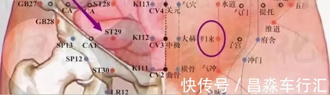 癌变|大家好!我叫“息肉”,癌症的近亲!我最怕无情又温柔的手术刀:艾灸