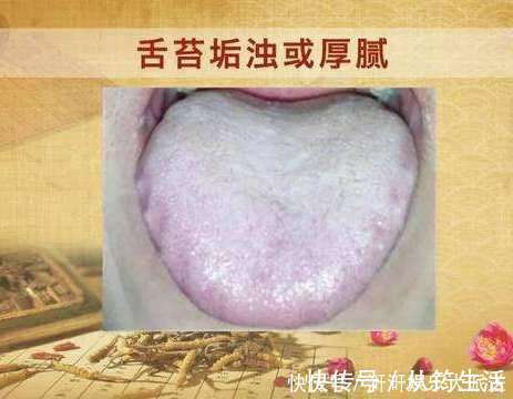 三子养亲汤|一个非常强大的方子,只需3味药,把痰湿彻底根除,神清气爽