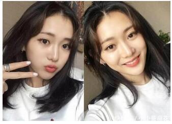 为什么咬肌越来越大,如何瘦咬肌型大脸?