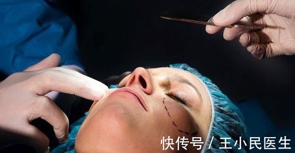 手术 拉皮除皱王小民教授：52岁做小拉皮一个月，看看她的变化！