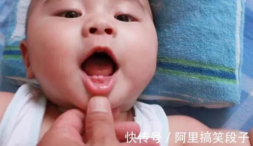 妈妈|宝宝出生就长牙？妈妈正开心，却被医生浇了冷水：苦难才刚刚开始