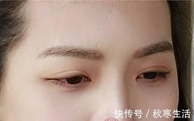 眼睛|眼疲劳怎么办有眼疲劳的人要这样做