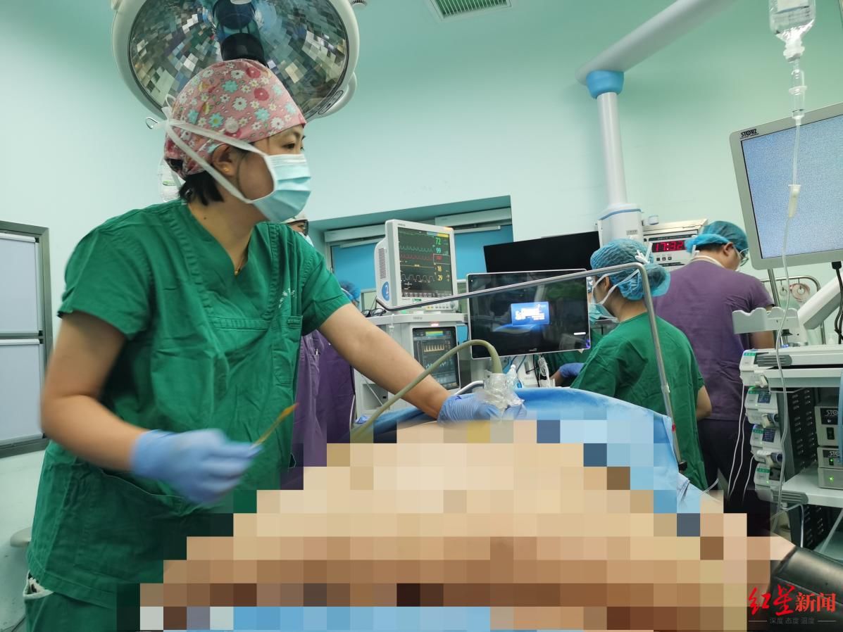 超级肥胖|526斤超级肥胖小伙手术减重,“再胖下去,人就没了”