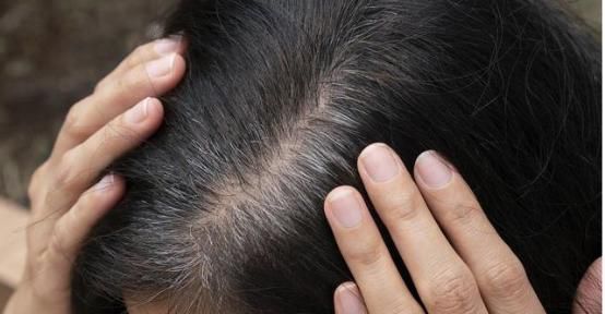 缺什么|缺什么维生素会长白发导致白发的原因有哪些专家来告诉您