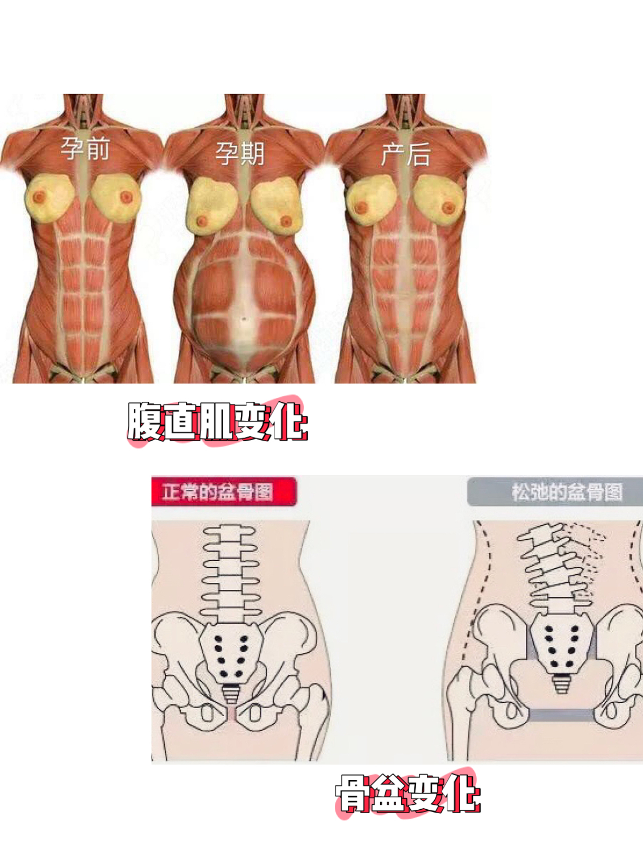 指南|产后修复避坑指南~产康修复别听婆婆的