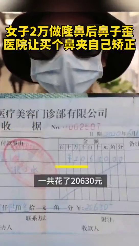 女子花2万隆鼻后鼻子歪了,医院让买个鼻夹自己矫正