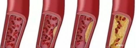 泡脚|50岁后,步入寿命“决定期”,若身体还能有5个表现,有望长寿