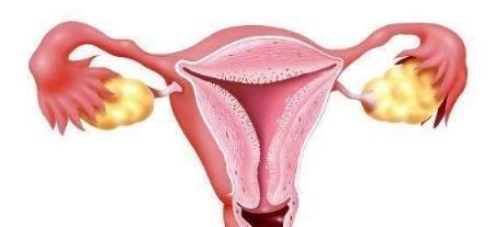 子宫内膜|这几件事最伤女性“子宫”!除了女性,男性才是最应该看看!