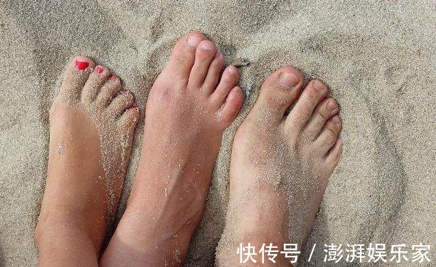 脚背|血管堵,脚先知,若脚上没有4种情况,恭喜,血管依旧“年轻”