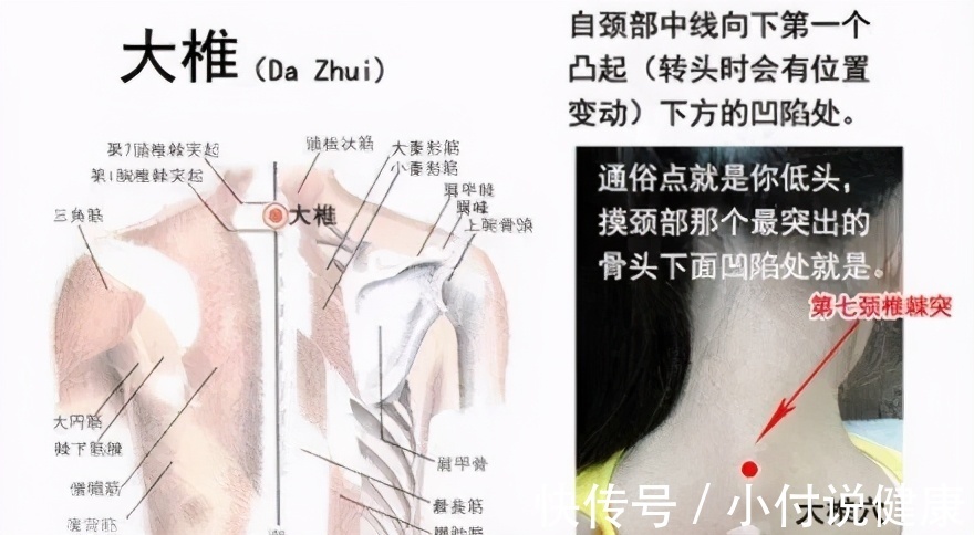 大椎穴|空调房里女性一定要保护的4个部位