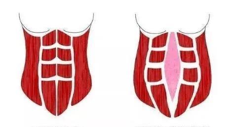 产后恢复|明明已经生完孩子了,怎么肚子还是这么大?