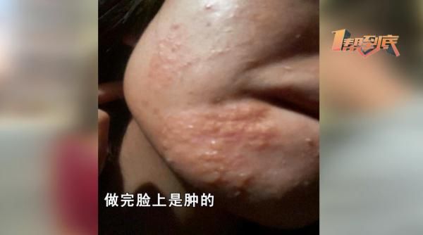 湘雅医院|海藻“焕肤”变“毁肤”，你却告诉我是因为熬夜导致“毁肤”？