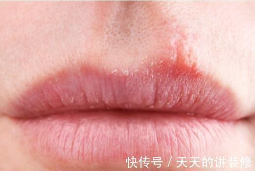 健康状况|寿命短,身体6处可能会发白,若一个不占,提前恭喜,长寿健康