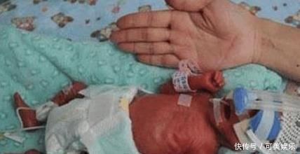 无痛人流手术|女孩怀孕多次没能有孩子，第8次终于有了结果，医生和护士却傻了