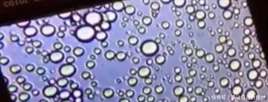 宝宝|母乳放大1000倍是什么样在显微镜下竟然是活的