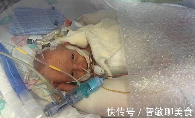 宝宝|英国妇女在怀孕21周时生下一个孩子宝宝是透明的,可以看到体内的血液流动