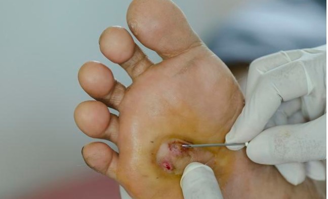 糖尿病|血糖过高,睡觉先知提醒睡觉有2个表现,提示糖尿病已到来