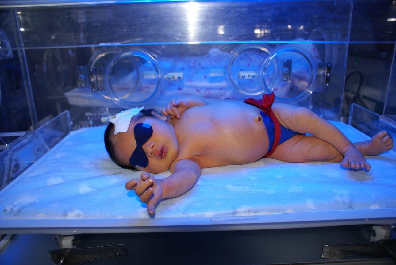 医生|想帮宝宝躲过“黄疸”,妊娠期间这样要求自己,就连医生都夸好