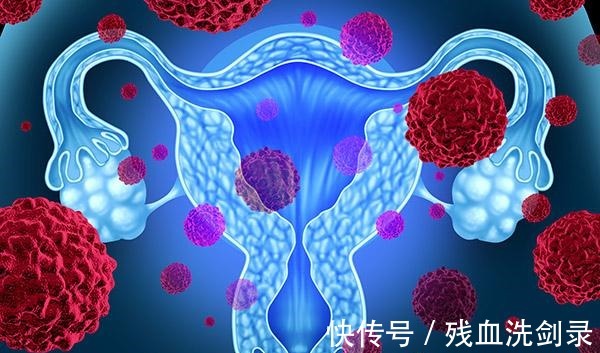 变胖|女性一到更年期会变胖发福做到这3点,瘦着度过更年期