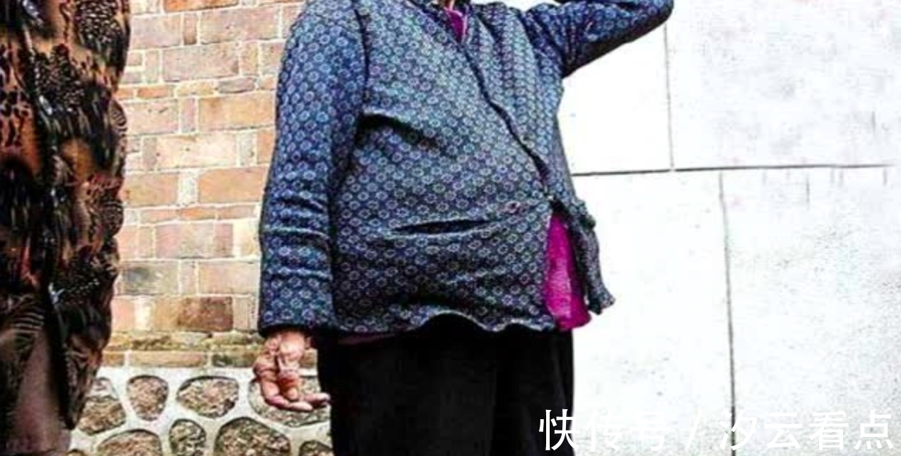 医生|90岁老人意外检查出怀孕!怀孕65年至今不知情,如今已无法生产