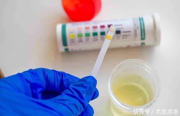 别忘了|肾出问题小便来提醒!尿完别忘了看一眼,及时发现异样