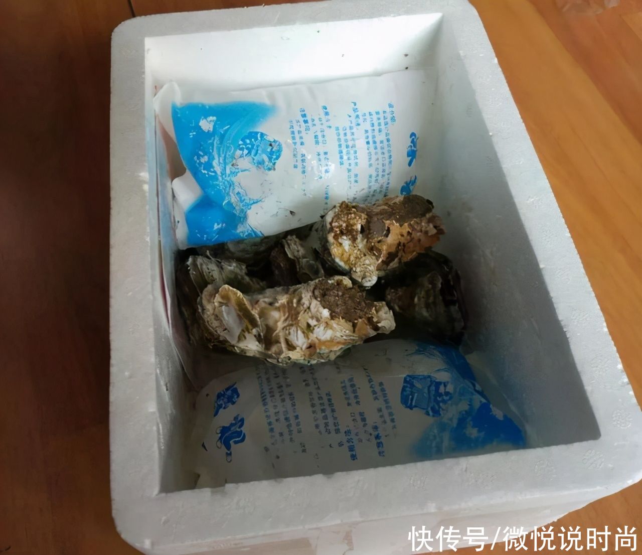 黑眼圈很严重怎么办？怎么拯救特别严重的黑眼圈？