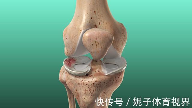 患者|膝盖疼,就是得滑膜炎了?医生辟谣,教您一步步判断自己的病因