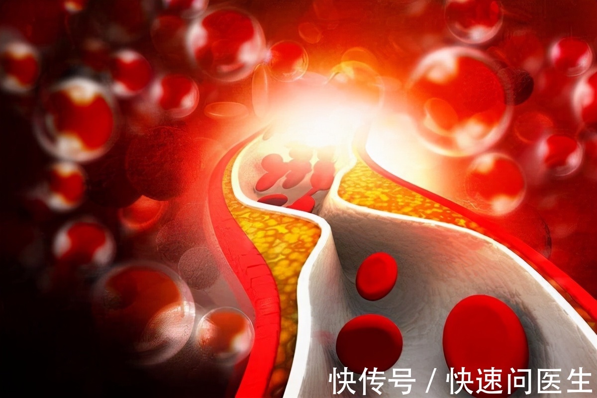 睡眠质量|用姜水泡脚,有哪些好处?身体或可收获3个好处