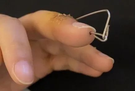 垃圾|女子扔个垃圾,手指断了要手术!这个习惯很多人也有