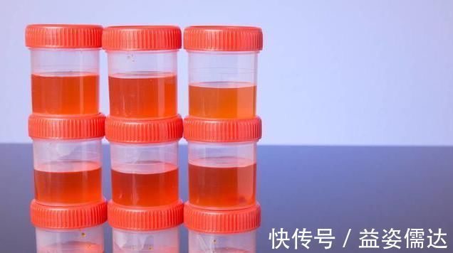 感染|不想蛋白尿拖垮你的肾，避开肾衰竭，医生给出3点实用建议