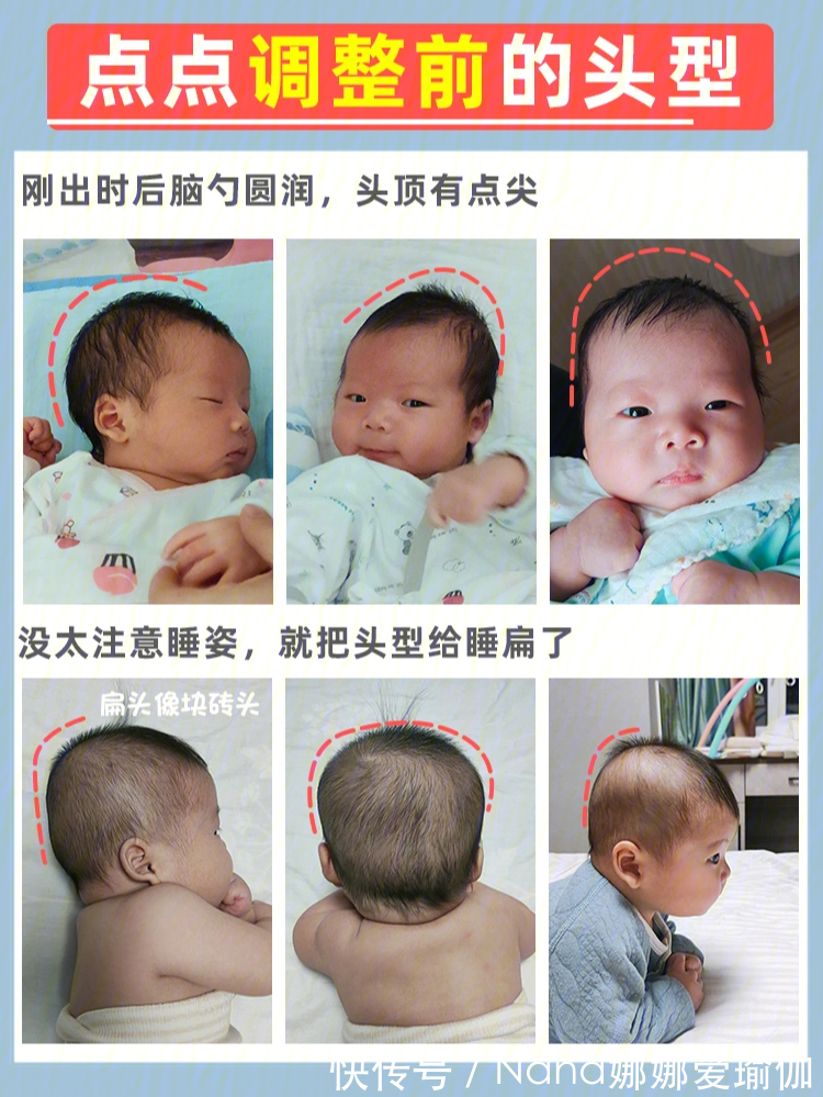 睡姿|宝宝睡圆头矫正头型,保姆级教程来了!