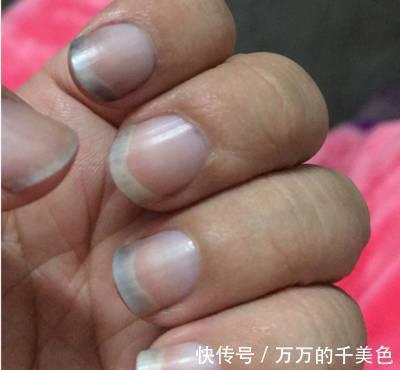 九蒸九晒黑芝麻丸|肾不好的人,身上会有2处发臭,2处发黑,若都没有,恭喜你了