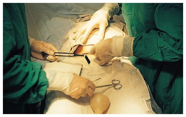 第一次剖腹产和第二次剖有啥区别？医生：同样是剖，区别却很大