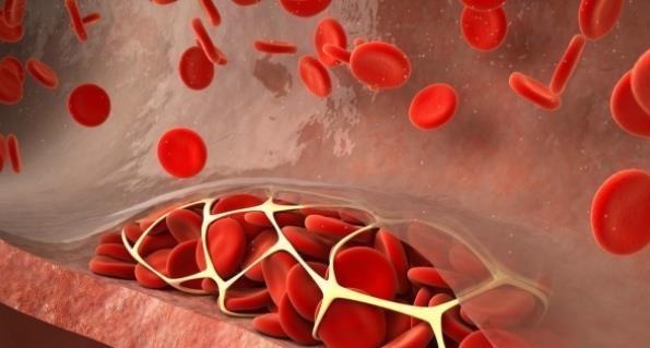 活血化瘀|丹参是一种血管清道夫,坚持吃的人不容易有血栓,但三类人不适合