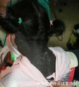 祸根|胎记长在哪里最有福气?恕我直言,2种胎记长哪都可能是祸根