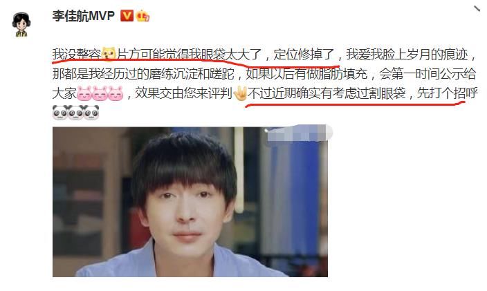 |李佳航被质疑整容，本尊回应超搞笑，称有割眼袋的打算