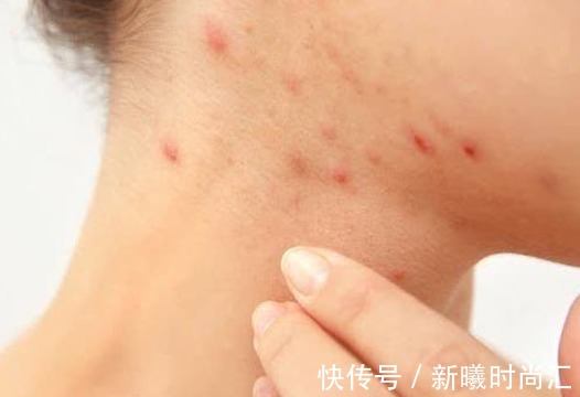 蒲公英水|17岁女生因一壶蒲公英水,送入医院,提醒:蒲公英泡水有4大禁忌