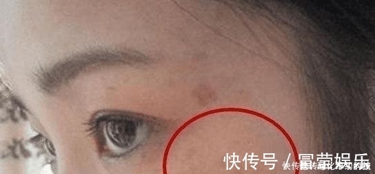 豆制品|女人患有妇科病,脸部会出现这3个暗号,发现1个就最好去查一查