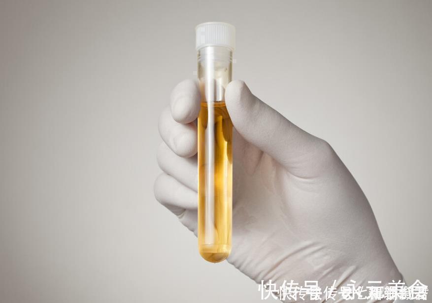 胆汁|肝脏的“黄金搭档”找到了，不是菊花，平时可劲喝，肝脏越发健康