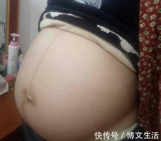 贴身物|怀孕晚期被诊断胎停育，医生怒斥太可惜太无知