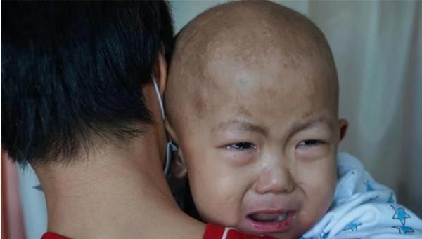 脑出血|1岁健康宝宝脑出血,只因奶奶用老方法哄睡,家长要引以为戒