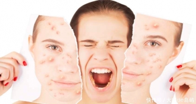 我成了激素脸,用什么护肤品都过敏,怎么办?急死我了!