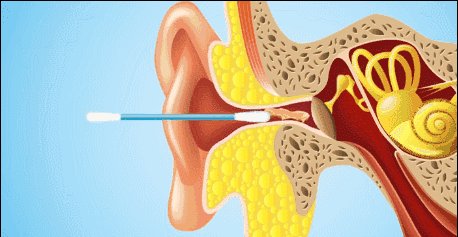 耳道|可怕，大妈掏耳朵竟掏出“癌症” ！医生：耳朵有自洁功能
