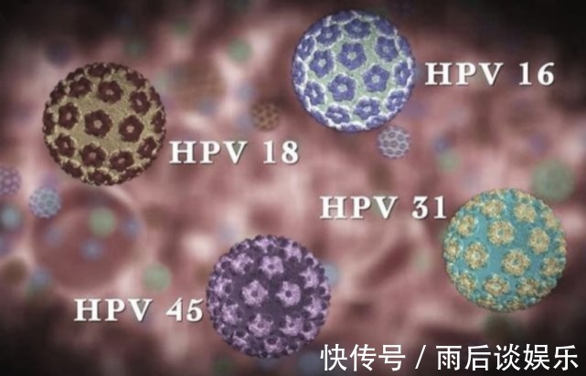 感染|同居出现这三种情况，女人要注意了，八成是感染了HPV，当心宫颈癌