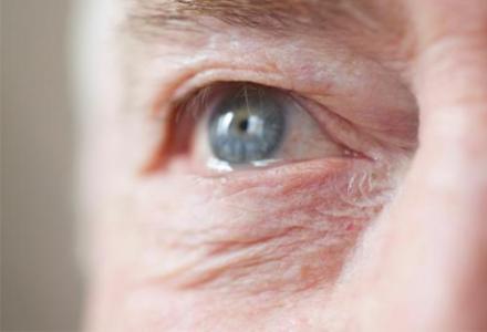 五脏|体内有癌，眼睛先知！异常出现在眼白上半部